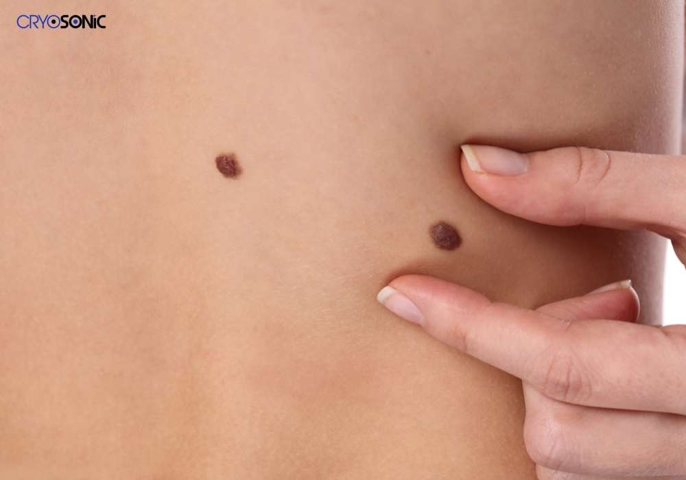 Infection Risk and Poor Aftercare Billericay