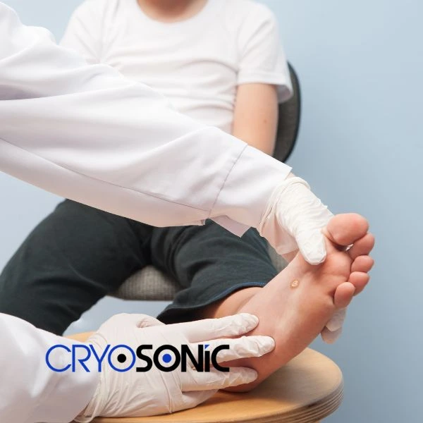 Are you looking for fast effective wart removal Contact us today Billericay