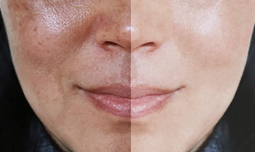 What Lifestyle Changes Support Skin Repair Billericay? Billericay